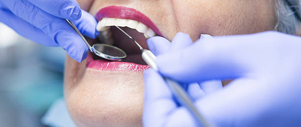 Best Emergency Dentist for Knocked-Out Tooth in Obetz, OH